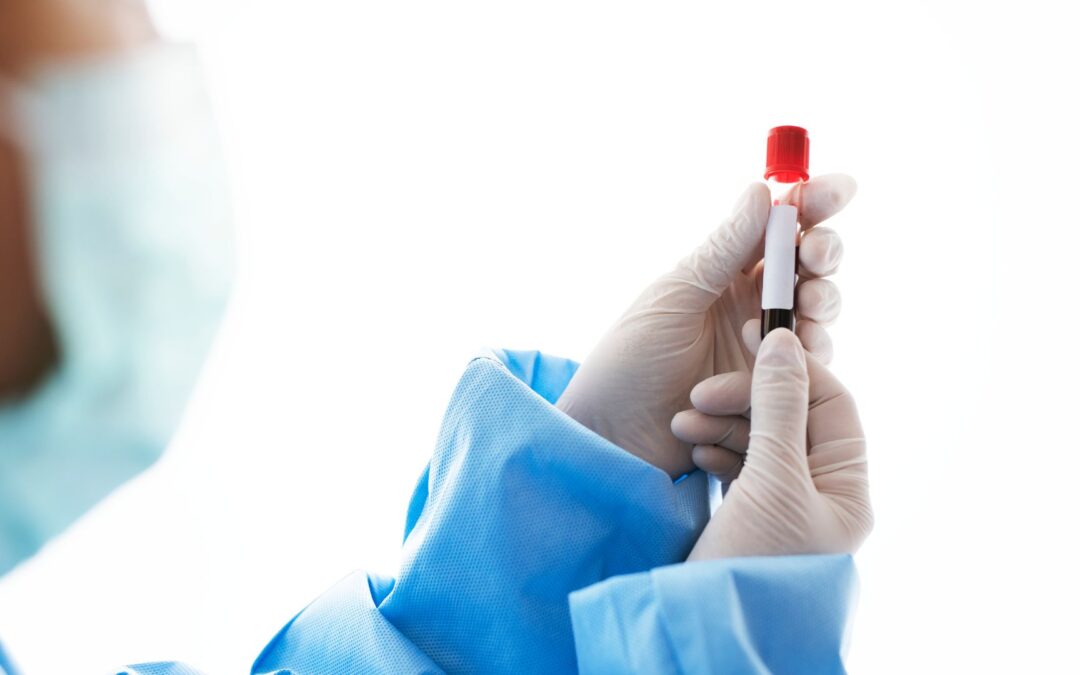Ferritina alta: entenda por que o excesso de ferro no sangue é preocupante