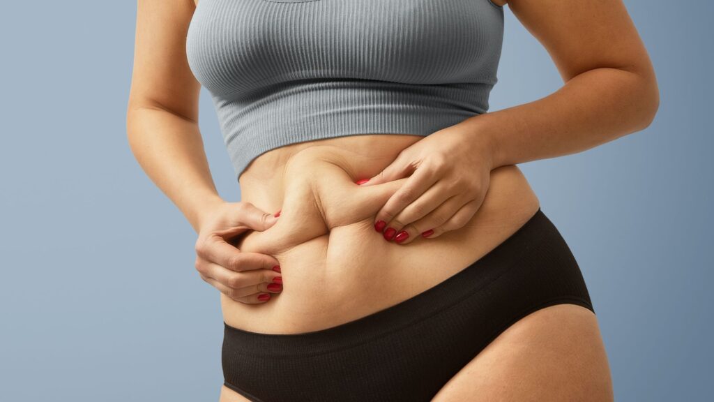 Mulher com excesso de gordura abdominal segurando a barriga