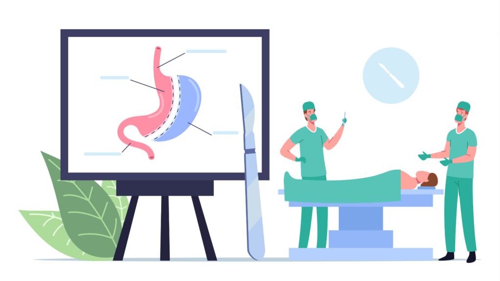 ilustração de uma cirurgia bariatrica