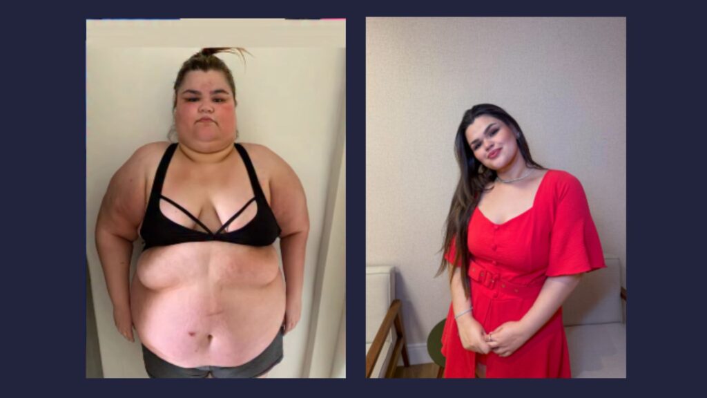 aline emagrecimento sem bariátrica antes e depois
