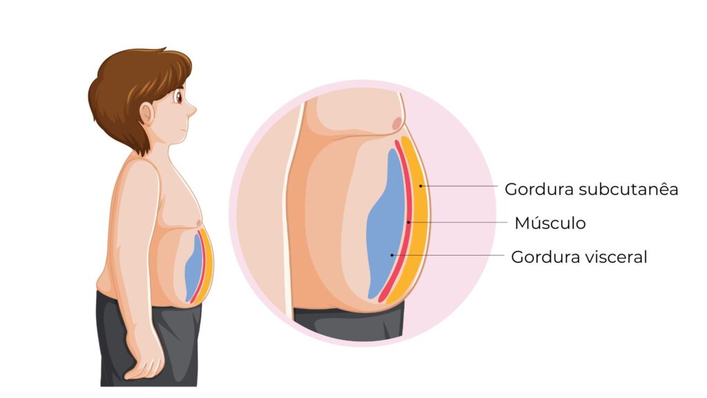 ilustração de gordura visceral