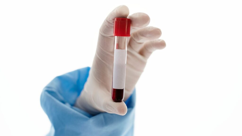 Médico segurando tubo de exame de sangue
